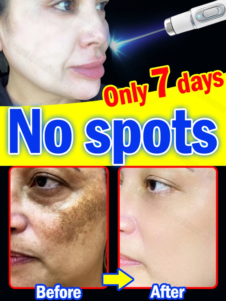 

Facia Dark Spots