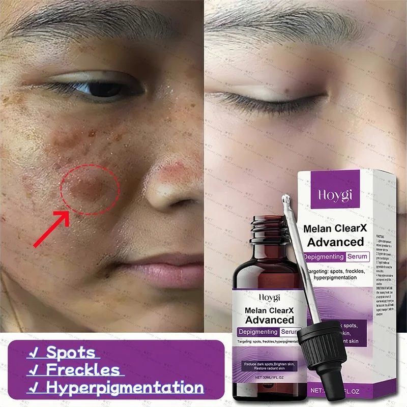 

Melan Clearx Advanced Depigmenting Serum Facial Spots Freckles Hyperpigmentation Removal Moisturizing Brighten Korean Cosmetics