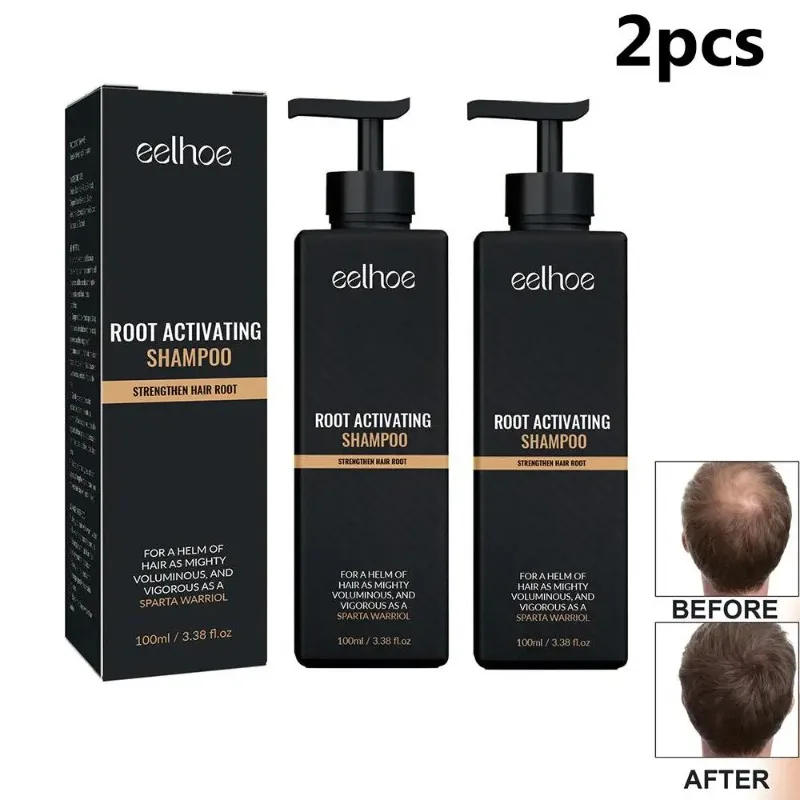 

2PCS Anti Baldness Shampoo Thickening Root Activator Shampoo Nourish Hair Regrowth For Thinning Hair & Hair Loss