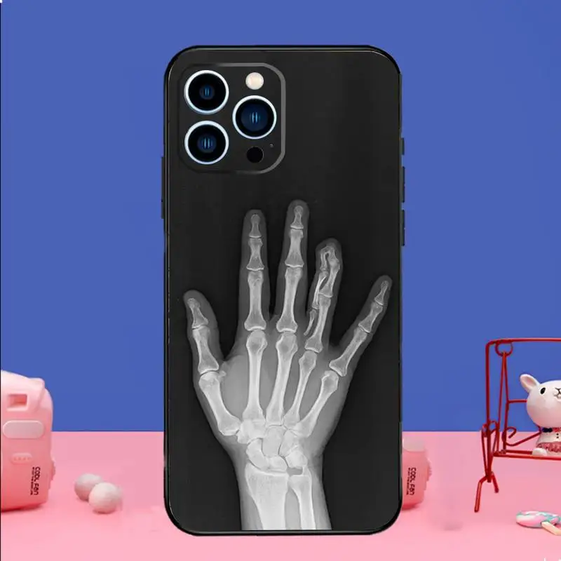 Radiological Human Skeleton Phone Case For iPhone 15 14 13 12 11 Pro Max Xs Xr X 7 8 Plus 12 13 Mini Silicone Black Cover