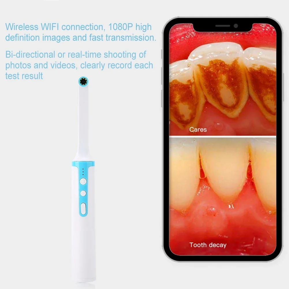 Tandheelkundige Kliniek Specifieke Intraorale Endoscoop Draadloze Wifi High-Definition Intraorale Spiegel Draagbare Pen-Vormige Home Camera Visueel