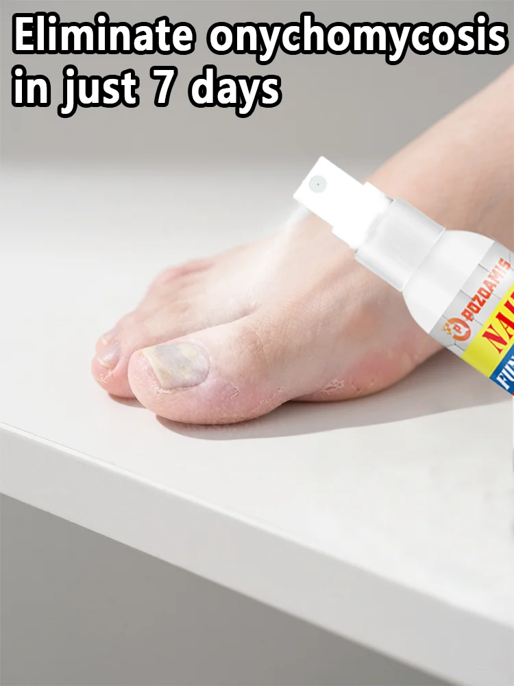 Spray de réparation des ongles, champignon des ongles des pieds, décoloration des ongles endommagés, outil de soins des pieds, 2025