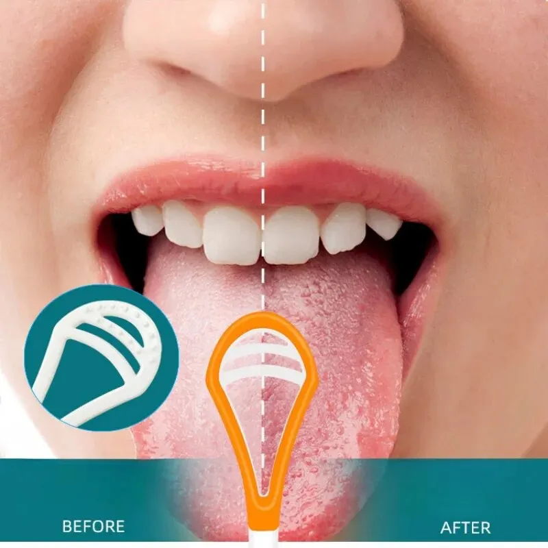 1Pc Dental Oral Hygiene Tongue Scrape Tongue Scraper Brush Scraper Oral Care Keep Fresh Breath Tongue Cleaner Tools