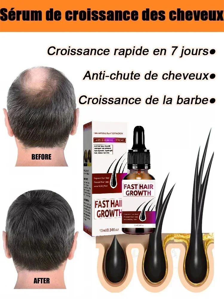 Hot selling product, 99% of buyers buy again, have more and more hair, say goodbye to baldness, thick hair