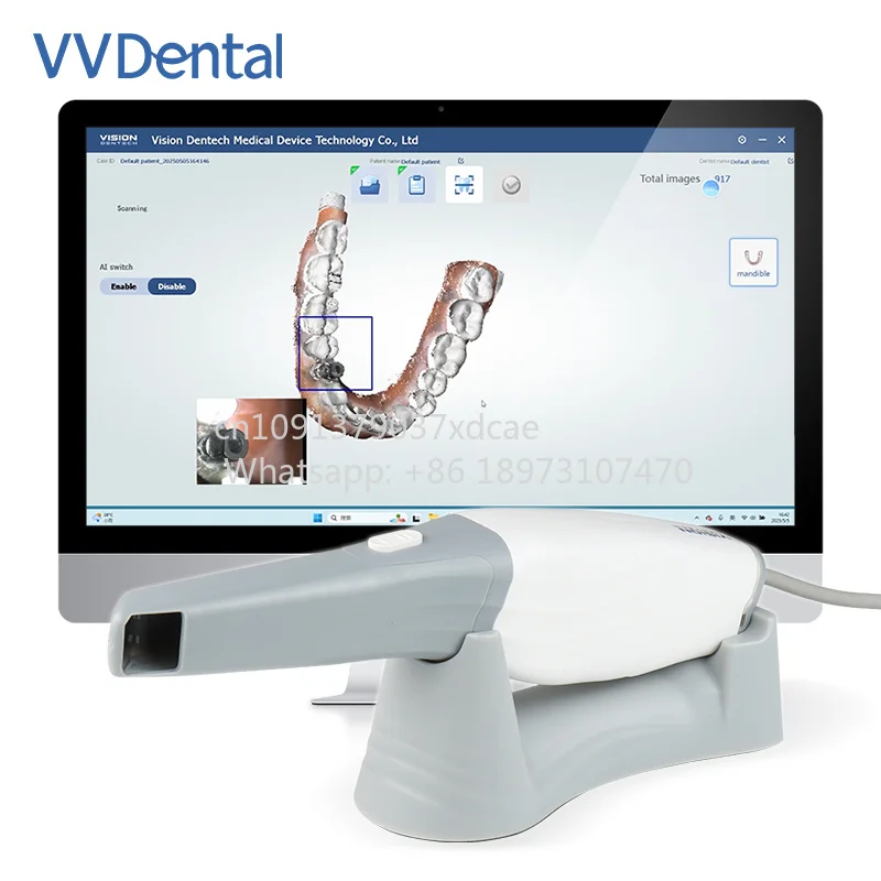 2026 New VV. Intraoral 3D Scanner With Software CAD CMD Implants Orthodontic Restoration Digital Impressionist Intraoral Sc