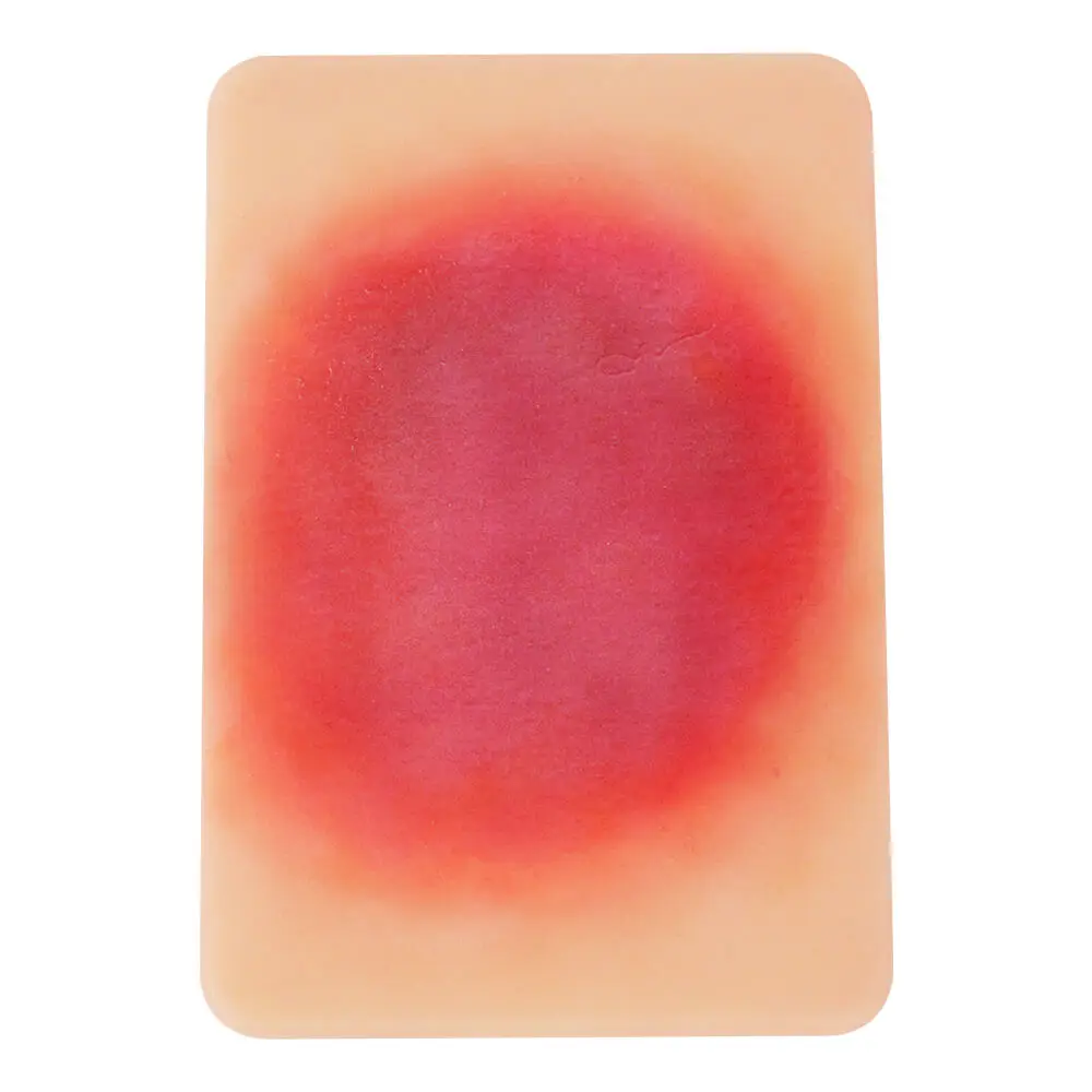 Ultrassist Bacterial Skin Infection Wound Models (Set of 4) Card-Sized for Medical Education Dermatologist Presentation Tools