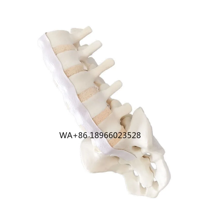 

Sawbones Solid Foam Human Lumbar 1 to Sacrum Lumbar Spinal Model with Nerve Roots for Orthopaedic Practice