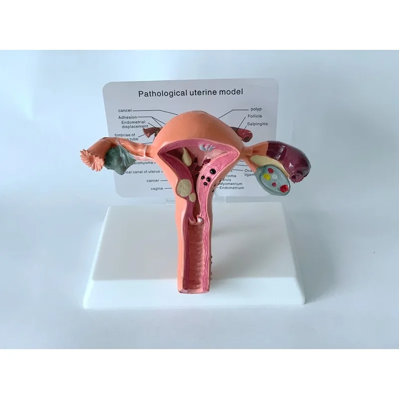 

Female Reproductive Uterus Vaginal Ovary Anatomy Teaching Model Mold Disease Change Science Teaching Aids Biology