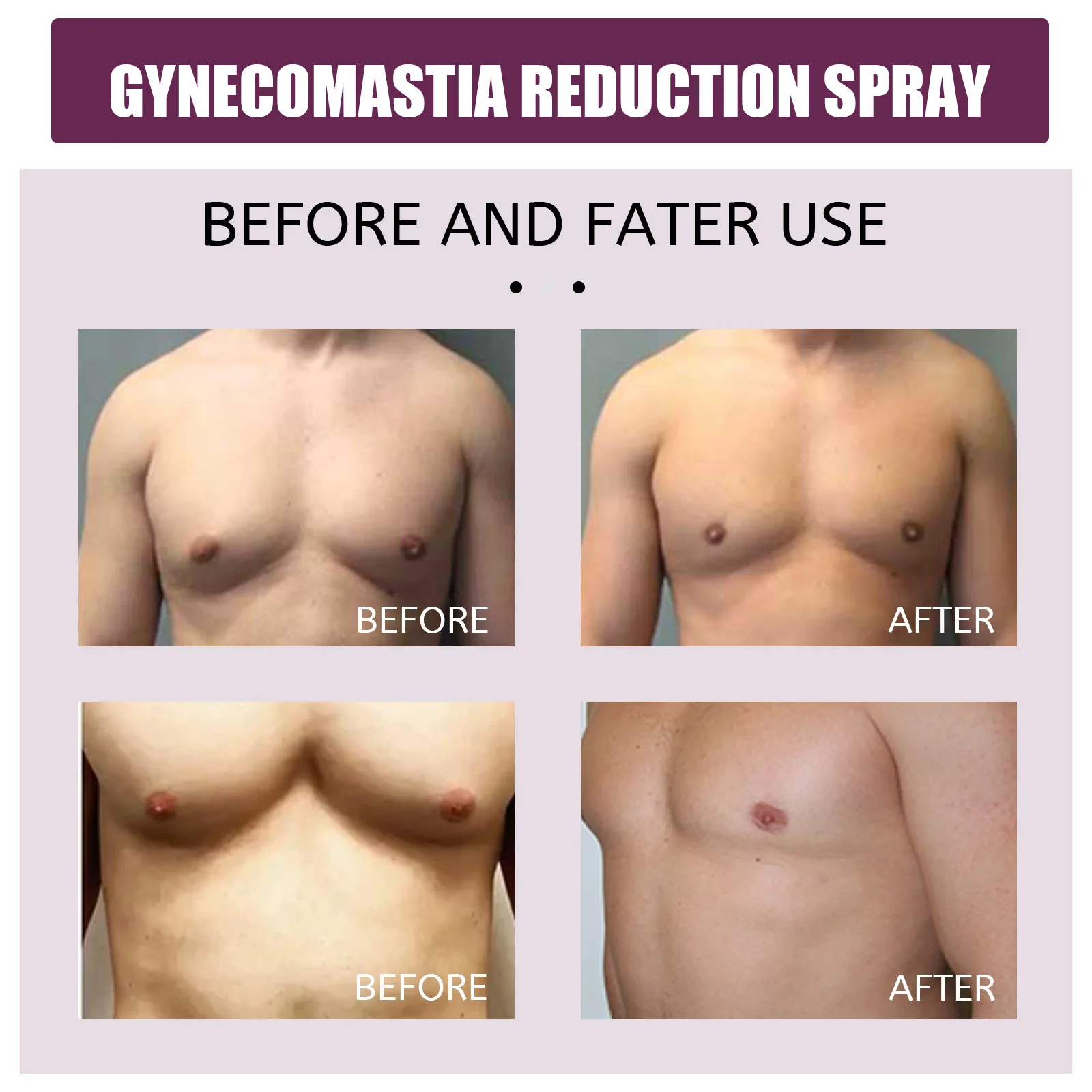 Gynecomastia Firming Spray Male Breast Growth Accelerating Pectoral Muscles Hardening Shrinking Chest Cellulite Reduction Spray