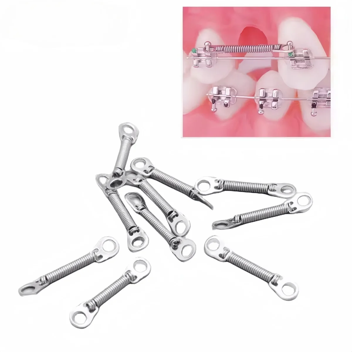 

Dental Orthodontics Niti Close Spring Open Coil Spring Light Force Length 6/9/12mm Orthodontic Materials Dentisty Correction
