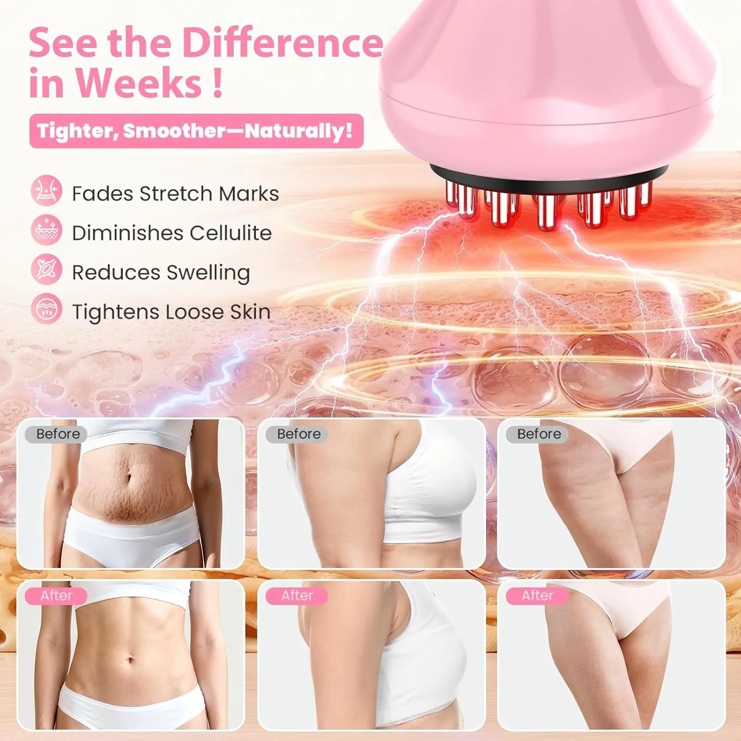 New Electric Meridian Brush 9 Levels Vibration Body Massager Shaping Reduce Stretch Marks Cellulit Relax Muscle Massage Tool