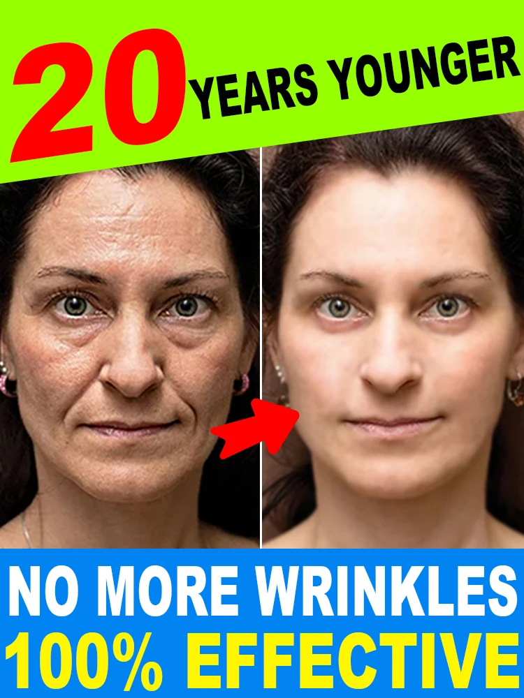 

морщины исчезают стать красивым сейчас