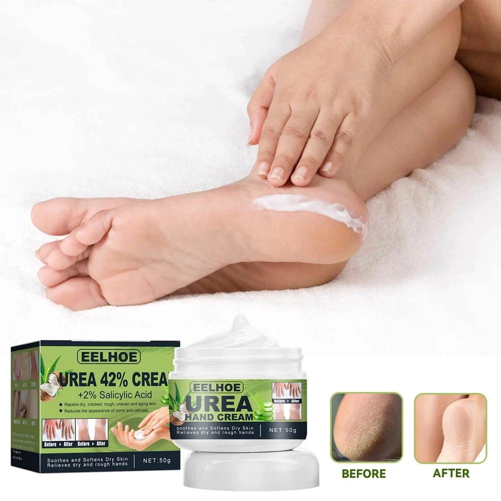 

50g Urea 42% Hand Foot Cream Dead Skin Repair Soften Cuticle Smooth Restore Moisturizing Anti Cracked Calluses Rehydration