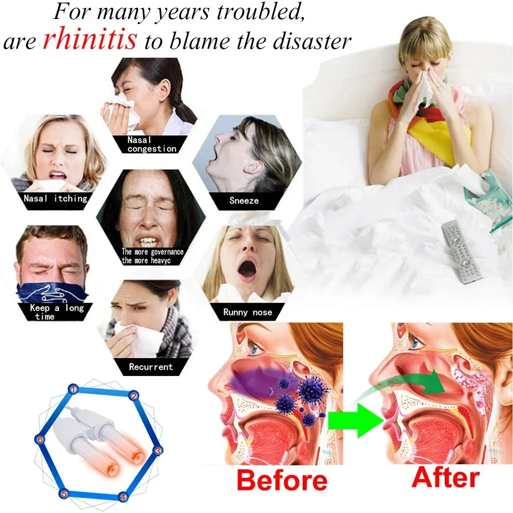 BioNase Nose Rhinitis Device Proxy Therapy Machine Sinusitis Cure Nose Care Hay Fever Low Frequency Laser Runny Sneeze Treatment