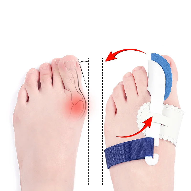 

1/2Pairs Toe Separator Hallux Valgus Bunion Corrector Orthotics Feet Bone Straightener Adjuster Pain Relief Pedicure Night Use