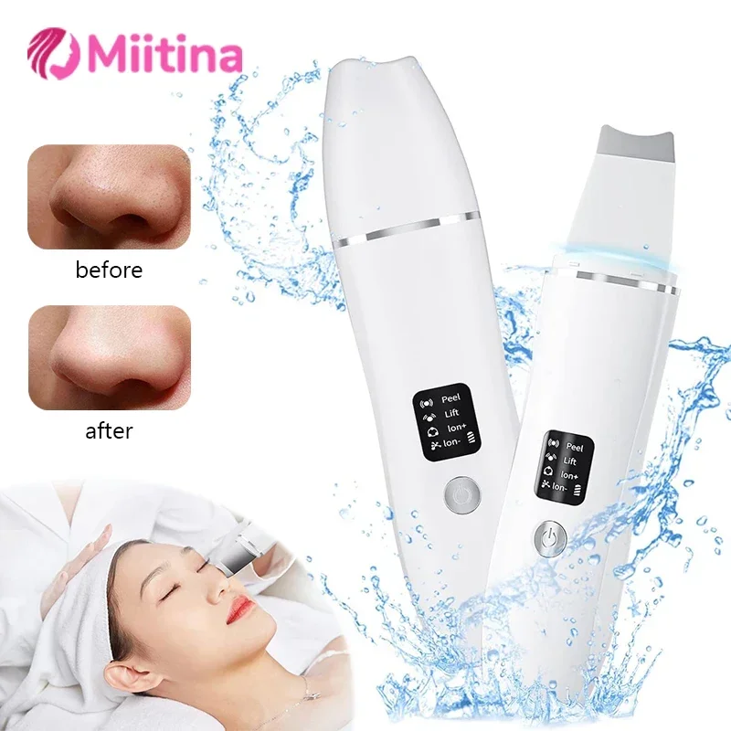 Ultrasonic EMS Skin Scrubber Face Care Blackhead Removal Cleaning Face Pore Cleaner Shovel Cleanser Acne Blackhead Remover Tools