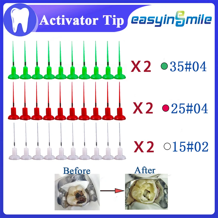 

EASYINSMILE Dental Endo Sonic Activator Tip Eddy Sonic Irrigator Tips Root Canal Clean 60Pcs