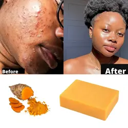 Turmeric Soap Aloe Vera Bar, Dark Spots Remover, Discolorations, Uneven Skin Tone Glutathion Skin Whitening Organic Soap