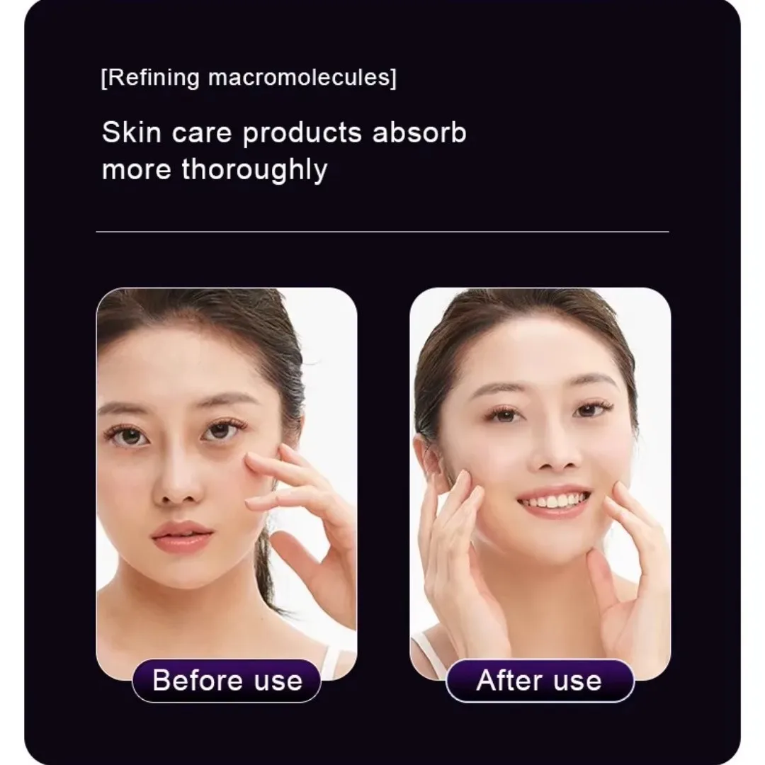 Appareil de beauté multifonction - EMS, cryothérapie et LED pour le lifting et le rajeunissement du visage