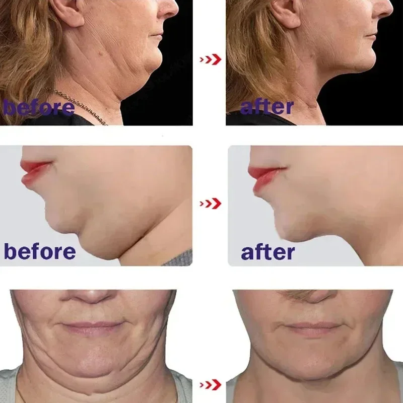 Hot V-Shape Slimming Cream Removal Double Chin Firming Tighten Mandibular line Slimming Masseter Face Muscle Fat Burning Cream