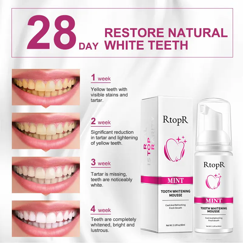 RtopR Mint Whitening Teeth Mousse Teeth Whitening Removes Dental Plaque Improves Yellow Teeth Stains Cleans Mouth Fresh Breath