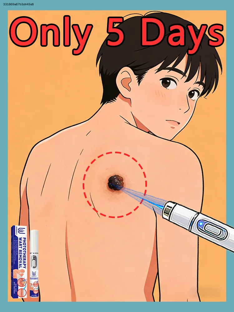 ʀᴇᴘᴀɪʀ ᴡᴀʀᴛs ʀᴏᴏᴛ ǫᴜɪᴄᴋʟʏ ɢᴇɴᴇʀᴀᴛɪᴏɴ ᴜᴘɢʀᴀᴅᴇᴅ，Worry-free，Free shipping