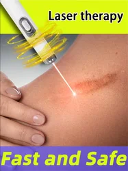 Laser therapy Keloid scar