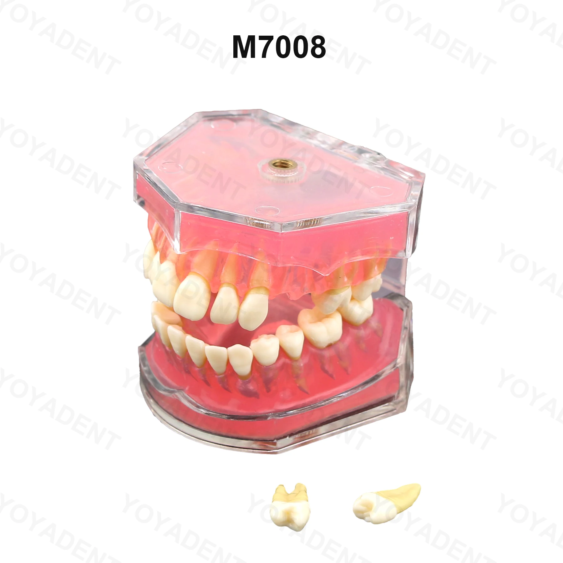 Dental Teaching Model Removable Tooth Model Simulated Cheek Doctor-Patient Communication Model Soft Gums Are Removable