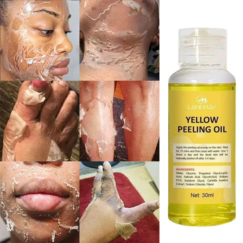 Yellow Peeling Oil For Dark Skin Bleaching Exfoliating For Face Lightening Body Peeling Dead Skin Removal Brighten Skin Tone 30M