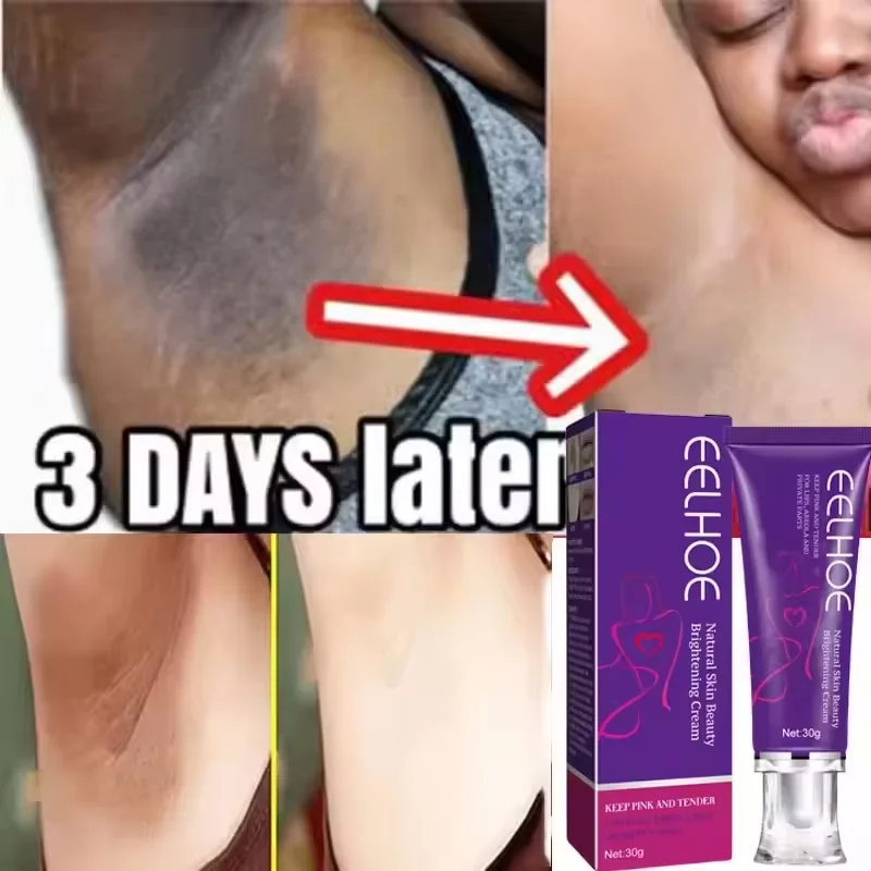 

Whitening Cream Private Parts Underarm Bleaching Serum Whiten Butt Knee Brighten Inner Thigh Intimate Parts Dark Remove Melanin