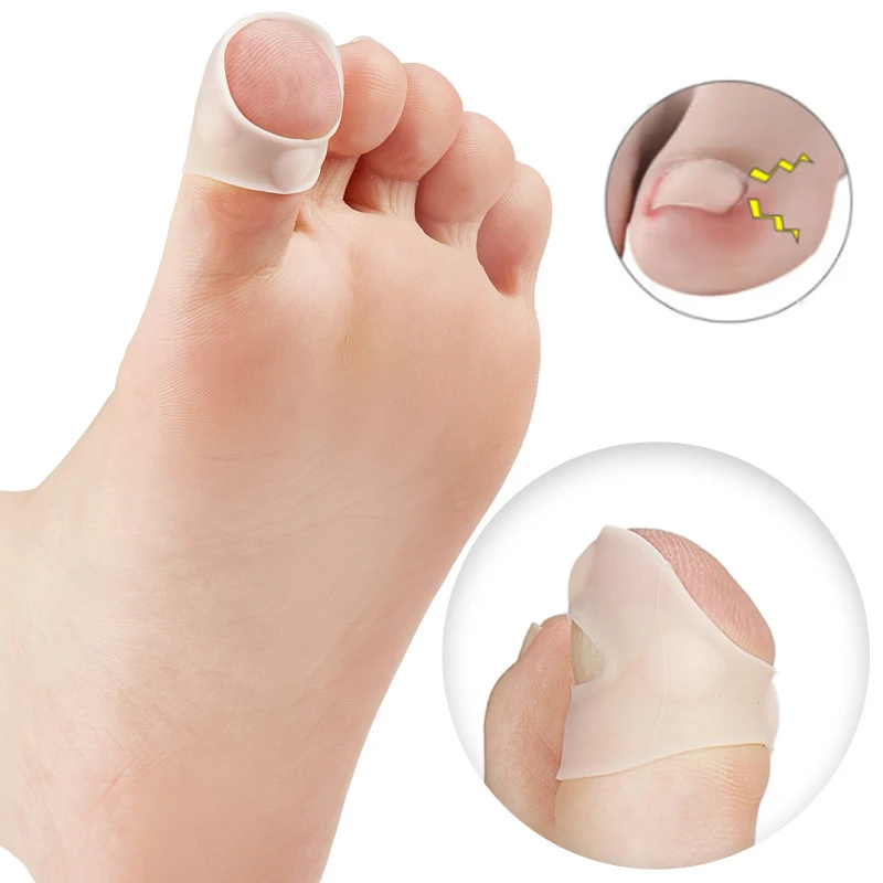 Correcteur d'ongles incarnés, outil de redressage des ongles des orteils réutilisable pour soulager la douleur, traitement fongique, soin Paronychia, outil de pédicure