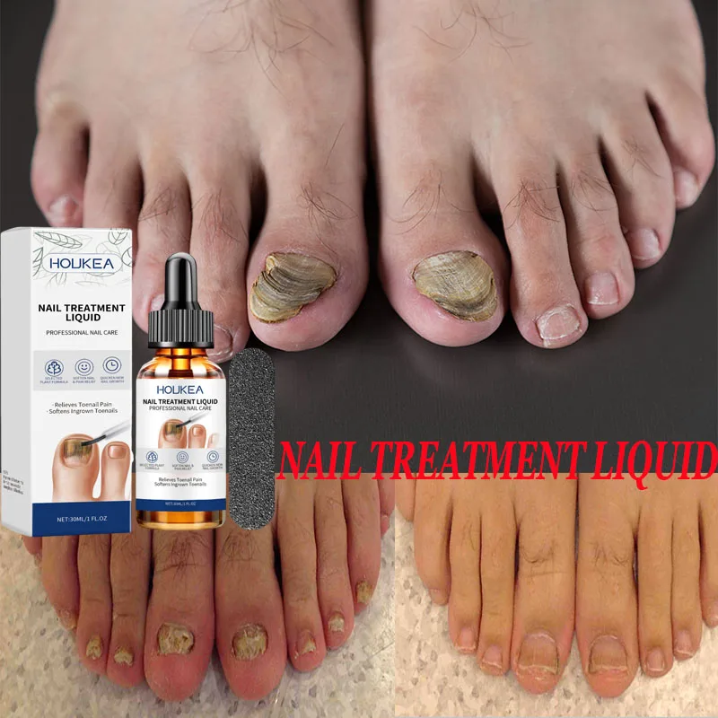 

Remove Gray Nail Care Liquid Gentle Moisturizing Repair Shine Nail Shine Nail Shine Nail Softening Nail Top Nail Nutrient Liquid