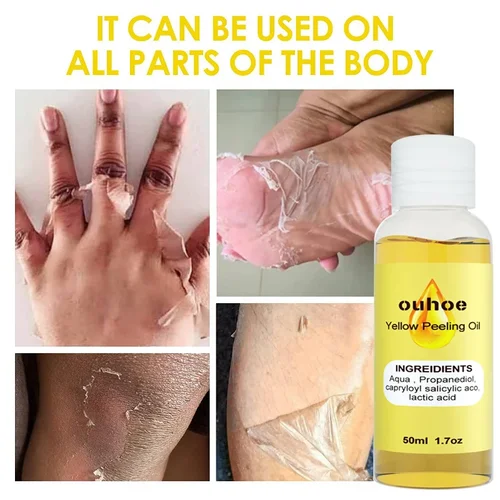 Imagen 2 del producto Aceite exfoliante amarillo para blanquear la piel oscura, elimina el brazo, la rodilla, las piernas, la melanina, aclaramiento corporal, exfoliante, suero blanqueador de piel muerta