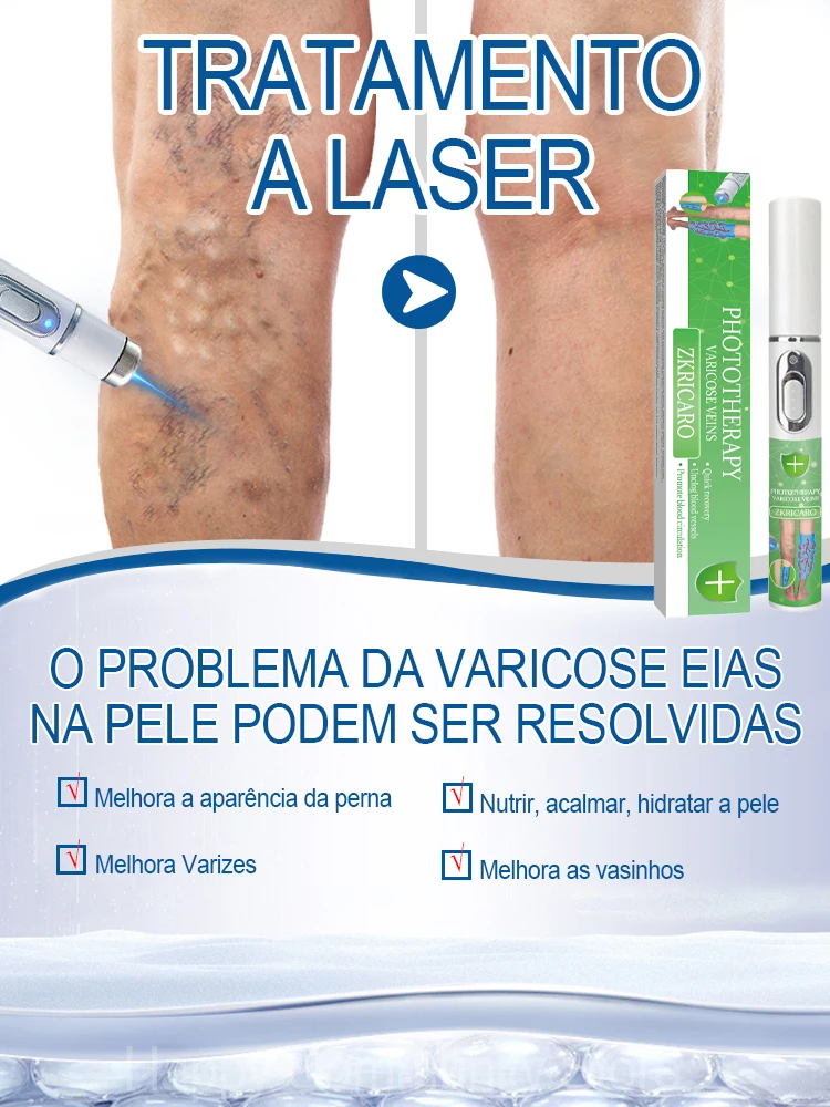 Hot sale Nano Laser Leg Vein