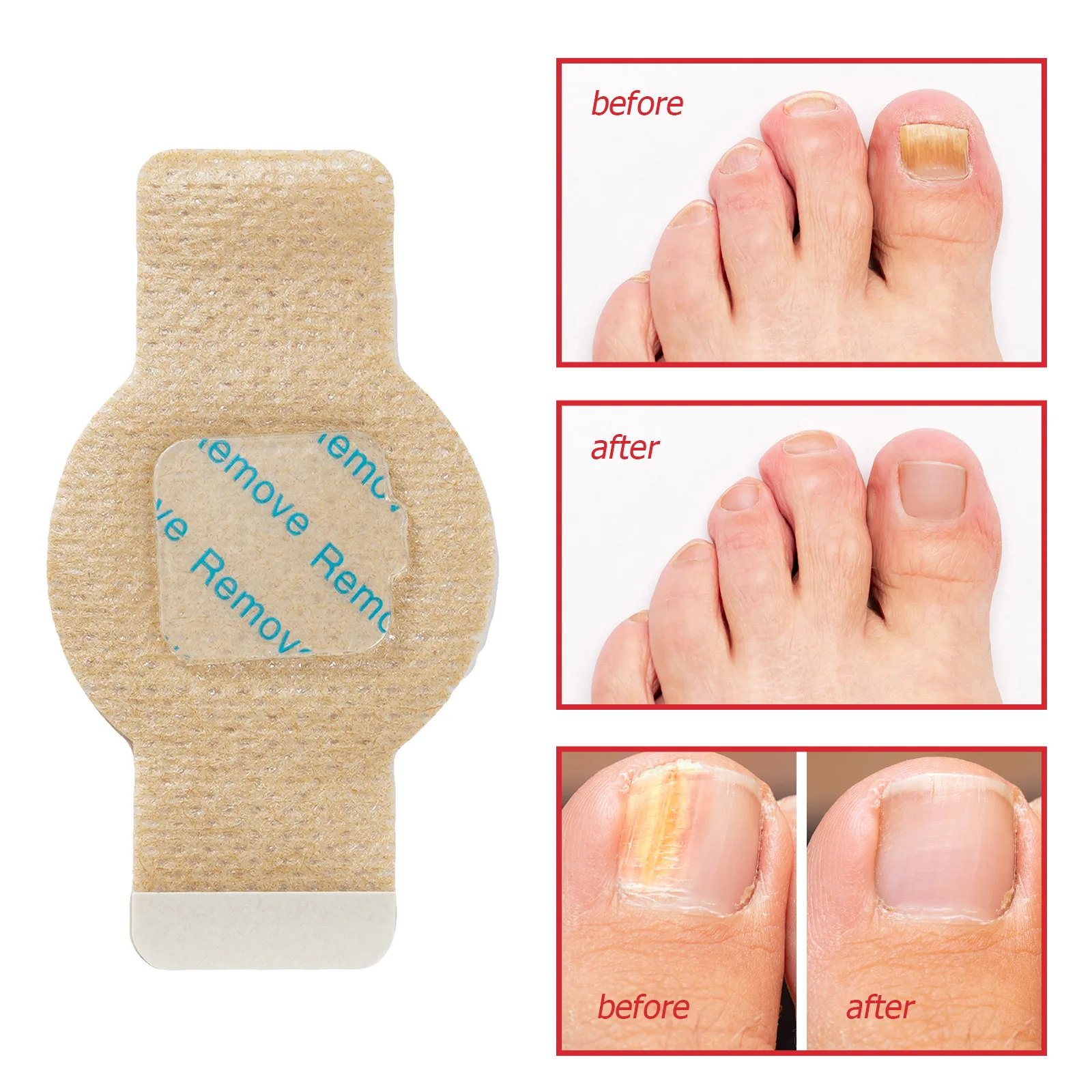 21 Pcs Nail Repair Patches Effortless Hydrogel Nail Care for Overnight Repair Infection Combat and Discoloration Improvement