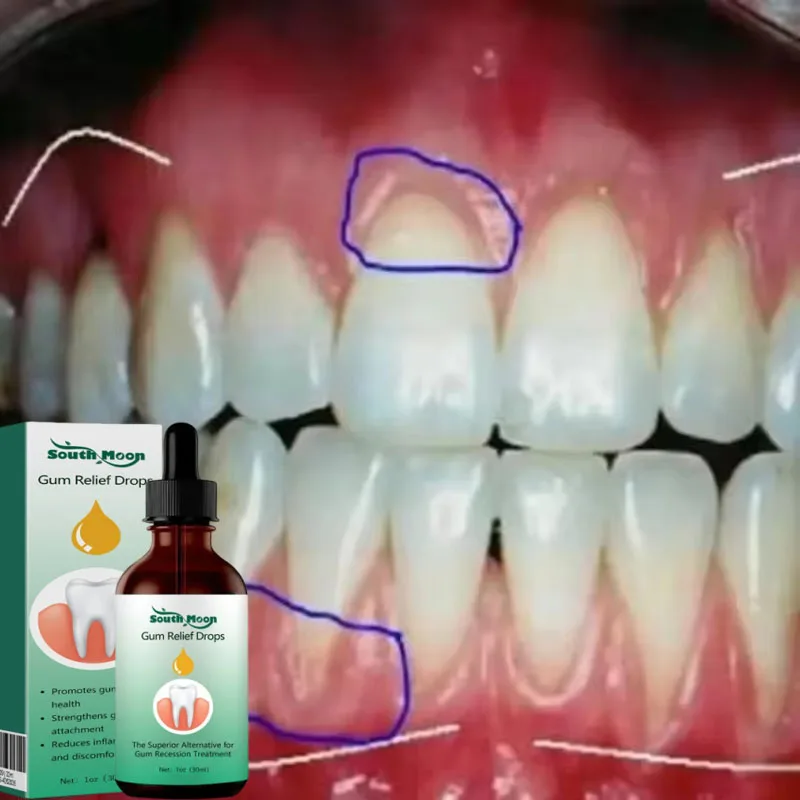 قطرات مصل إصلاح اللثة تخفيف إعادة اللثة علاج اللثة الصفراء التهاب البلعوم آلام الفم تنظيف مضاد للجراثيم العناية بالأسنان
