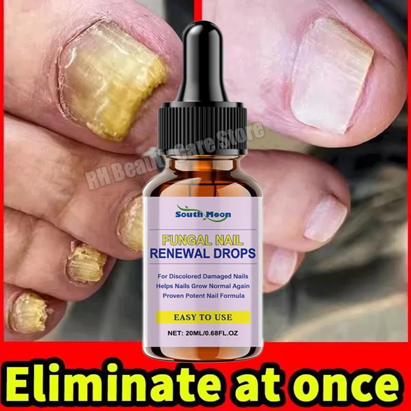 Nail Fungal Repair Serum Foot Toe Nail Fungus Removal Essential Oil Anti Infection Onychomycosis Paronychia Repairing Care