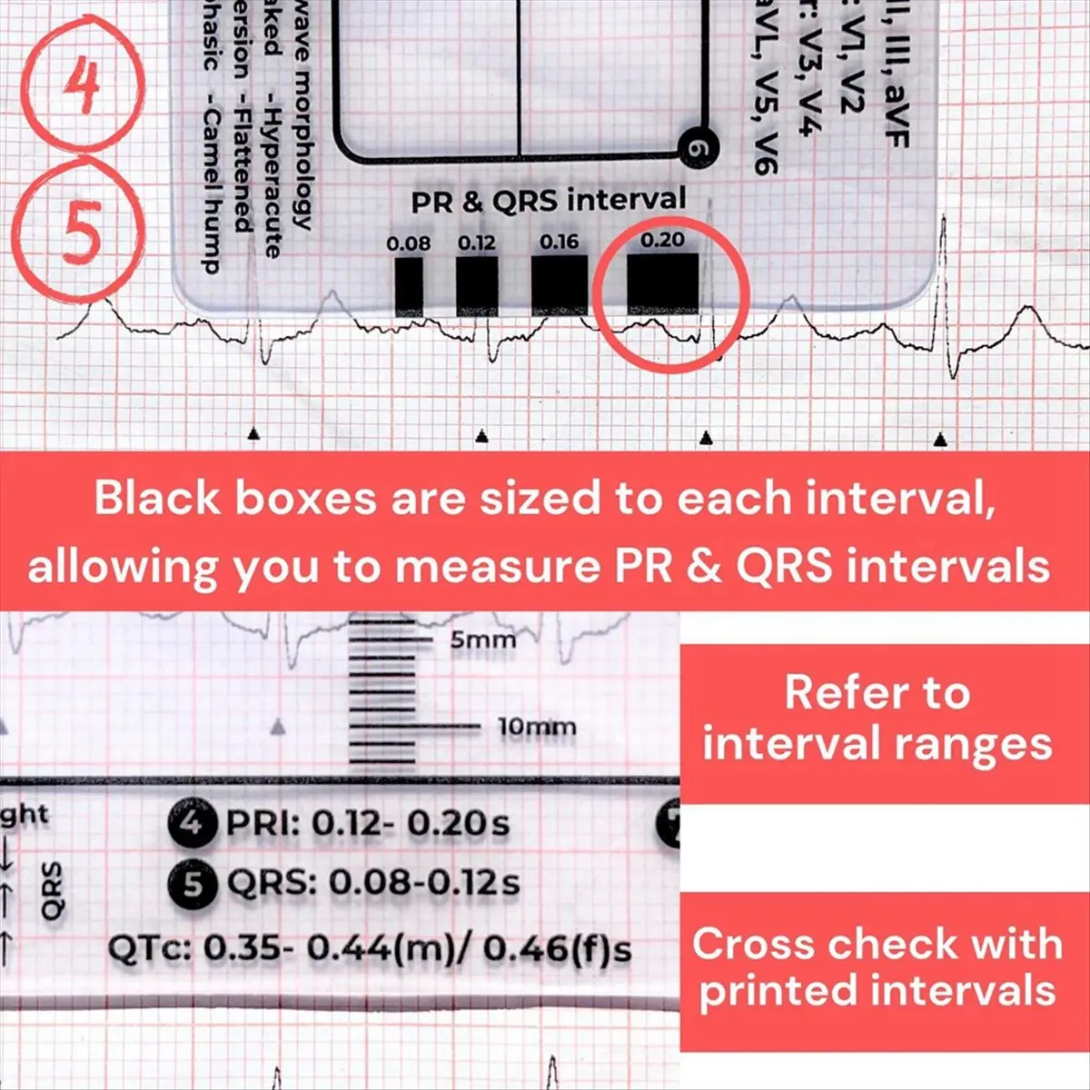 AT16 2pcs ECG 7-Step Ruler Rapid and Rapid Heart Analysis and Measurement Tool, Follow 7 Steps to Read ECG