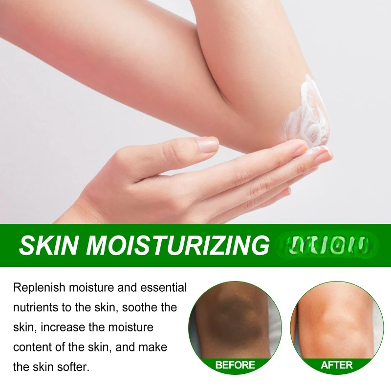 Whitening Cream for Dark Skin Armpit Lightening Intimate Areas Underarm Body Skin Care Private Parts Whiten Cream Beauty Health