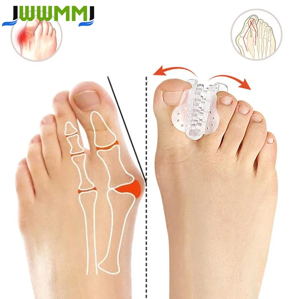 1Pair Toe Separator, Big Toe Spacers, Single Loop Toe Spreader for Bunions, Overlapping Toe, Corrector and Spacer