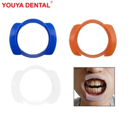 3pcs/lot Dental Mouth Opener Intraoral O Shaped Lip Cheek Retractor Expanders Holder Teeth Whitening Dentist Materials Tools