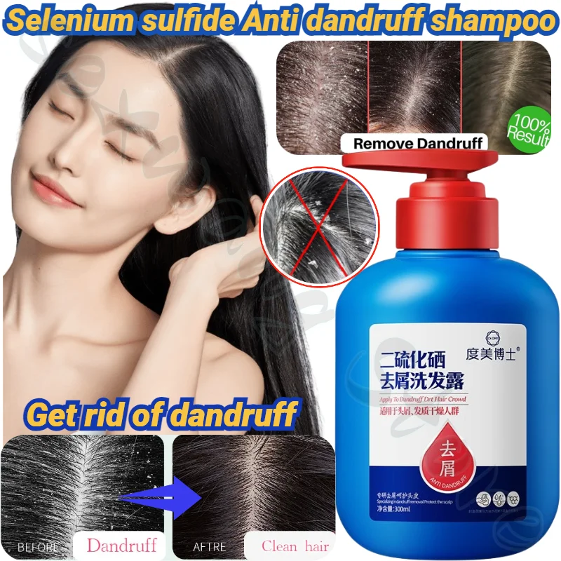 

Get Rid of Dandruff, Anti-dandruff, Anti-itch, Soothing Scalp Shampoo, Herbal Plant Extract Natural Shampoo 300ml