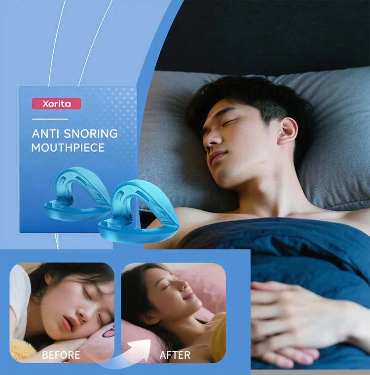 Xorita Anti Snoring Mouthpiece Reusable Snore Device Stopper Reduce Snoring Aid Snore Solution For Comfort Easy Breathing