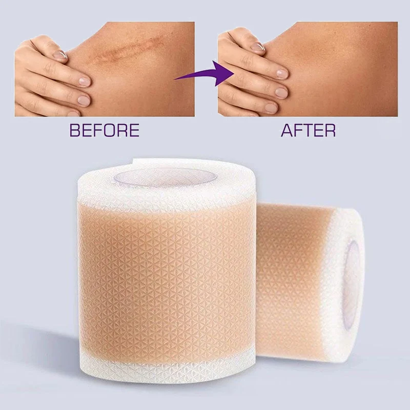 

Водонепроницаемая и дышащая силиконовая лента для шрамов — многоразовый клейкий пластырь цвета кожи для ушей, занятий спортом и защиты от трения