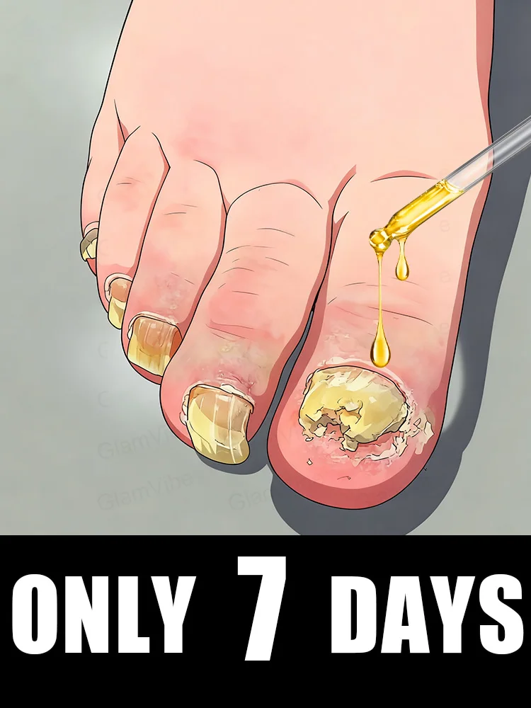 

Tᴏᴇɴᴀɪʟ Fᴜɴɢᴜs Pᴀᴛᴄʜᴇs Rᴇᴘᴀɪʀ Dɪsᴄᴏʟᴏʀᴇᴅ Dᴀᴍᴀɢᴇᴅ Nᴀɪʟs Fᴏᴏᴛ Cᴀʀᴇ2025