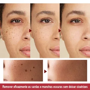 10 Hauptverkaufsplasma -Stift -Tipp - №2