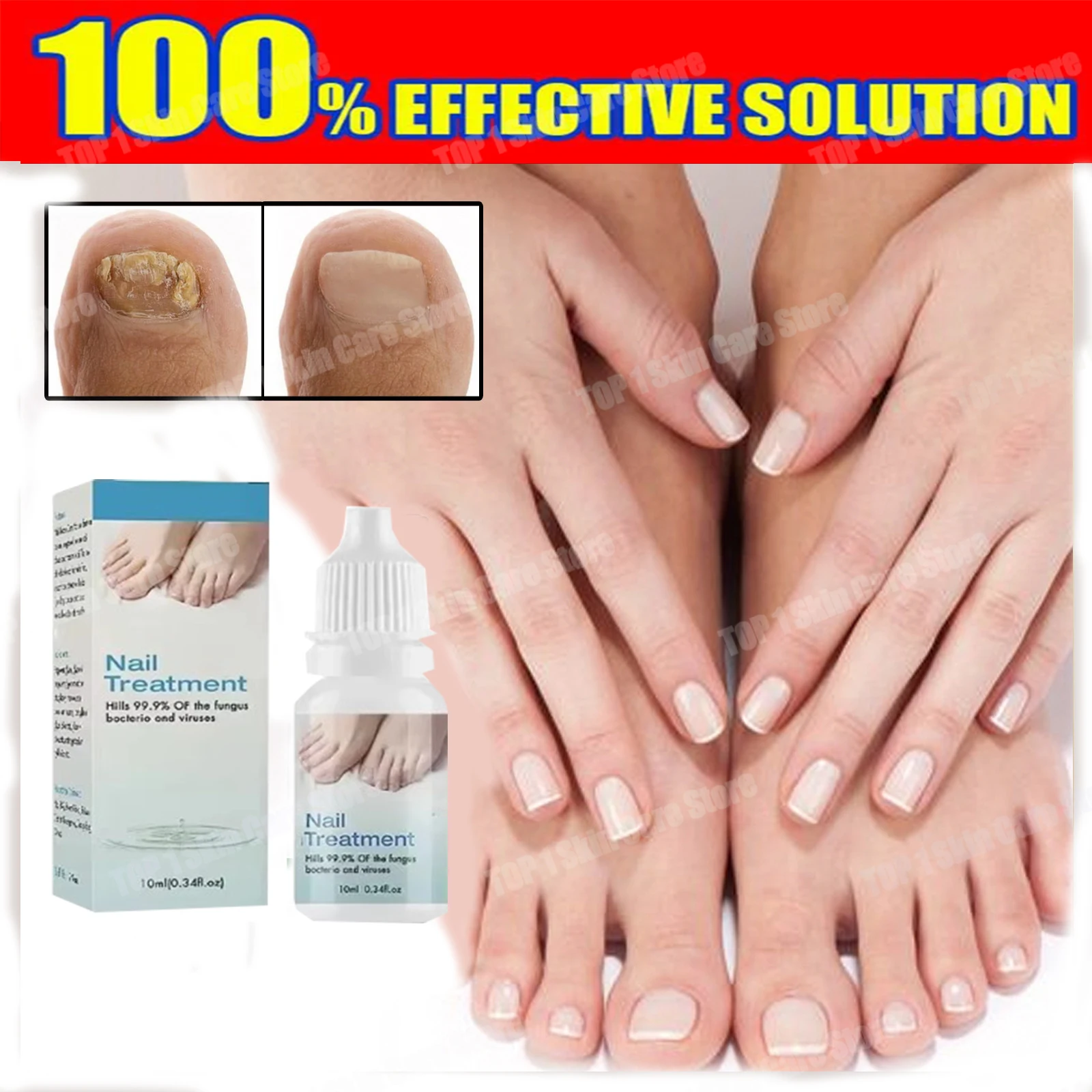 

New10ml Onychomycosis Repair Serum Ointment Onychomycosis Paronychia Care Cream Nail Toenail Foot Care Repair Essence