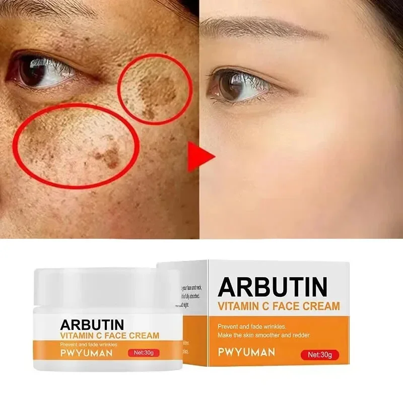 

Vitamin C Whitening Freckles Cream Remove Dark Spots Melasma Niacinamide Lighten Melanin Anti-aging Brighten Skin Care Products