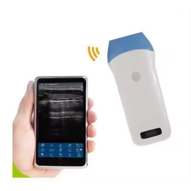 ultrasound instruments handheld vascular 3 in 1 USB scanner wireless probe for