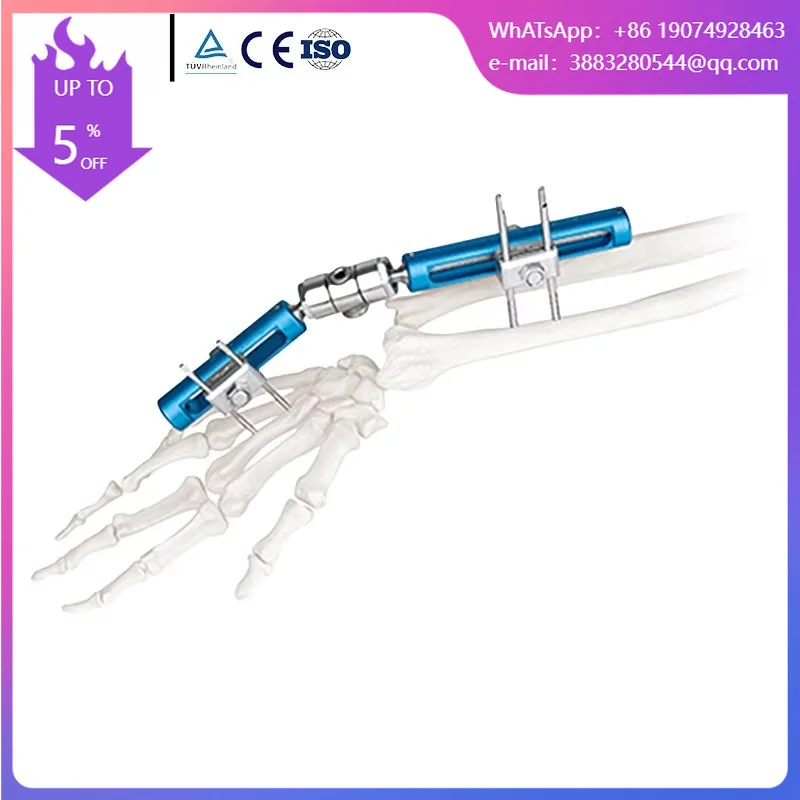 Mini Orthopedic External Fixator, Single Lock Wrist Joint External Fixator,Factory Direct Supply